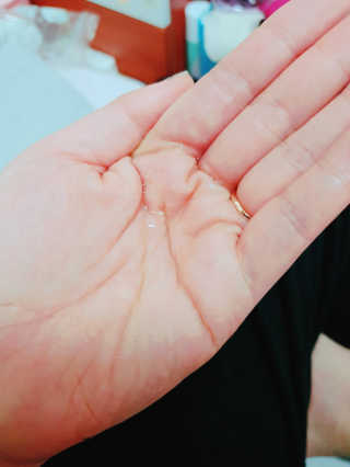 키노닉스 펀더멘탈 하이드레이팅 앰플 부스터 — 4.5점을 준 리뷰어가 2019년 2월 올린 사용 사진
