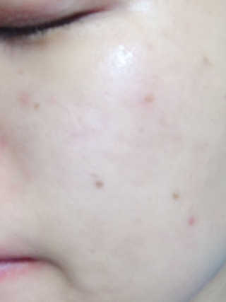 바디버든프로젝트 바디버든 프로젝트 BBP 시카 토너패드 — 5점을 준 리뷰어가 2019년 7월 올린 사용 사진