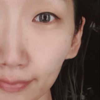 자이엘 S.O.S 레드 칙 케어팩 2 Box — 5점을 준 리뷰어가 2019년 11월 올린 사용 사진