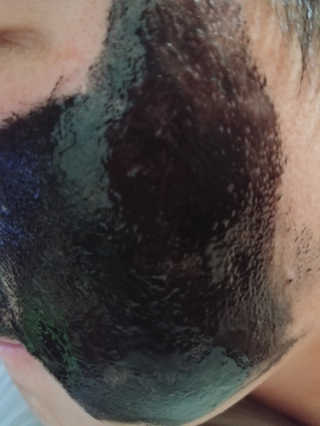 퓨어힐스 포어 클리어 블랙 챠콜 필오프 팩 — 5점을 준 리뷰어가 2019년 3월 올린 사용 사진