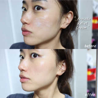 [후르디아] 민감피부 안심, 아보카도 토너+크림 세트 — 5점을 준 리뷰어가 2020년 3월 올린 사용 사진