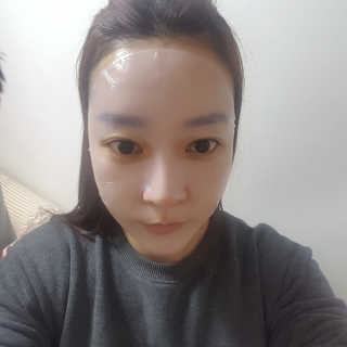 유리스킨-바이오셀룰로오스 마스크 젤리마스크 5매 — 4.5점을 준 리뷰어가 2018년 3월 올린 사용 사진