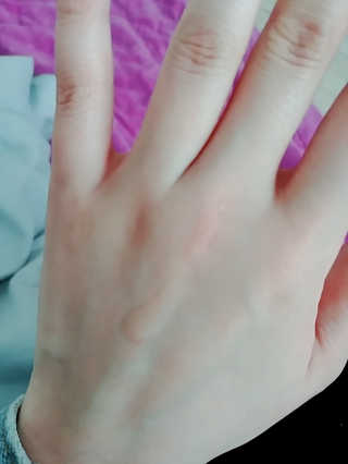 비건화장품 멜릭서 피부 활력 부스터 멜릭서 비타민 세럼 — 4.33점을 준 리뷰어가 2019년 3월 올린 사용 사진