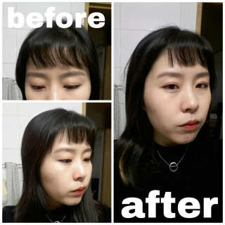 다슈코리아 다슈 데일리 뽕채가루 펌프형 — 2.5점을 준 리뷰어가 2017년 3월 올린 사용 사진