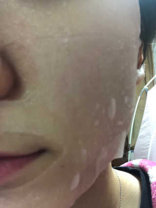 라인플라츠 인텐시브 업 화이트닝 블루베리 마스크 — 5점을 준 리뷰어가 2019년 2월 올린 사용 사진