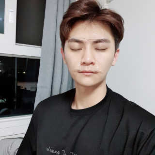 아이디플라코스메틱 아이디 페이스핏 플러스 패치 — 5점을 준 리뷰어가 2019년 10월 올린 사용 사진