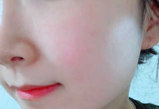 보타니티 [홍]조[진]정[결]케어 플라본 세럼 — 5점을 준 리뷰어가 2018년 5월 올린 사용 사진