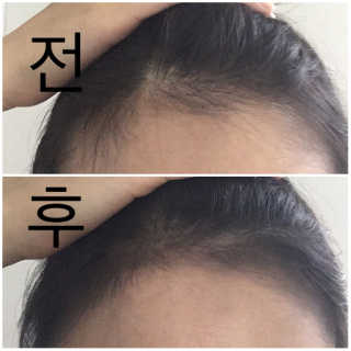 인블리님이 올린 리뷰 사진 2