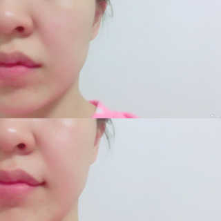 고려은단 메가도스 동안피부 필수품 ! 고함량 순수 비타민C 20% 앰플 — 5점을 준 리뷰어가 2016년 10월 올린 사용 사진