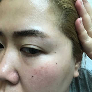 Emogurloveskincare님이 올린 리뷰 사진 3