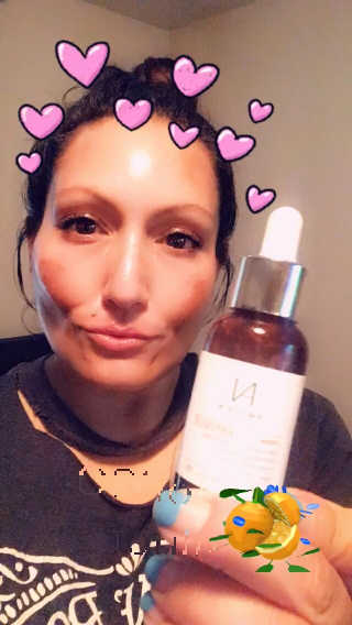 앰플엔 AMPLEN VC SHOT AMPOULE — 4.83점을 준 리뷰어가 2018년 9월 올린 사용 사진