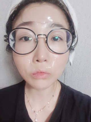 아이디플라코스메틱 아이디 페이스핏 플러스 패치 — 3점을 준 리뷰어가 2019년 10월 올린 사용 사진