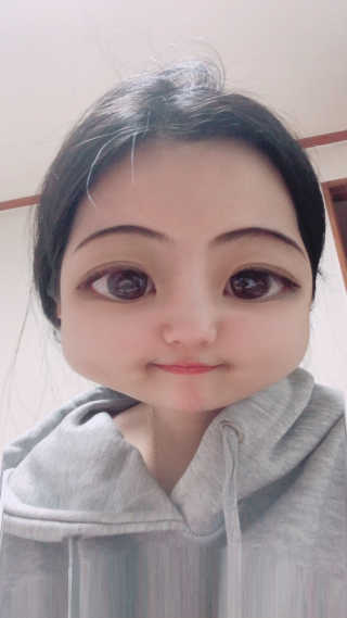 아이디플라코스메틱 아이디 페이스핏 마이너스 밴드 — 4점을 준 리뷰어가 2019년 11월 올린 사용 사진