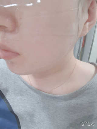 어셀리 브릴리언스 솔루션 하이드로겔 페이셜 마스크 — 5점을 준 리뷰어가 2020년 1월 올린 사용 사진