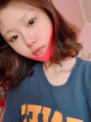 스케덤 펩타이드 리프팅밴드 — 4점을 준 리뷰어가 2019년 6월 올린 사용 사진