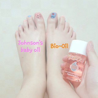 Bio-oil(바이오오일) 바이오오일(Bio-oil) — 3.5점을 준 리뷰어가 2016년 8월 올린 사용 사진