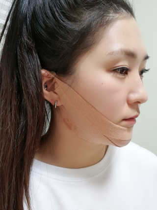 아이디플라코스메틱 아이디 페이스핏 마이너스 밴드 — 5점을 준 리뷰어가 2019년 11월 올린 사용 사진