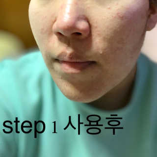 8TY 코스메틱 에잇티 8TY 2 STEP 솔루션 마스크 — 4.5점을 준 리뷰어가 2019년 6월 올린 사용 사진