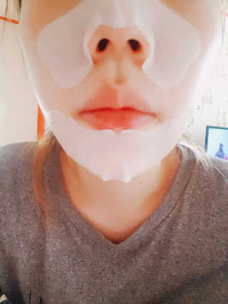 나이팅게일 TAKO PACK NOSE [문어코팩] — 5점을 준 리뷰어가 2017년 4월 올린 사용 사진