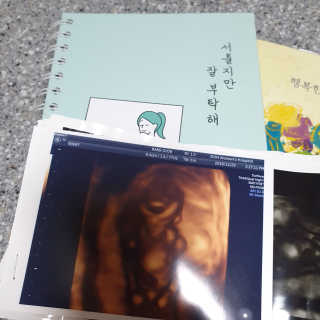 찌니허니님이 올린 리뷰 사진 2