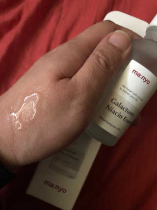[마녀 공장] 발가락 토미 니아신 에센스 50ml — 4점을 준 리뷰어가 2019년 4월 올린 사용 사진