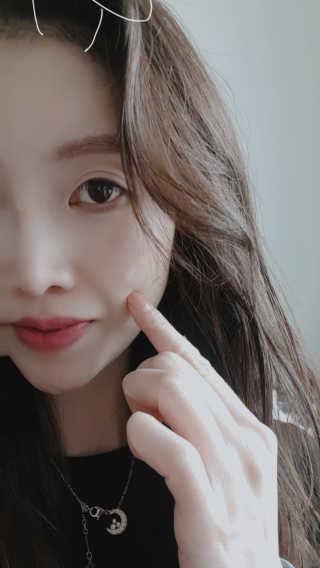 캐치미패치 트러블 스팟패치 — 5점을 준 리뷰어가 2019년 12월 올린 사용 사진