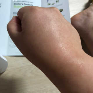 [이지함화장품]닥터스포뮬러 어드밴스드화이트닝 토너 — 4점을 준 리뷰어가 2019년 8월 올린 사용 사진