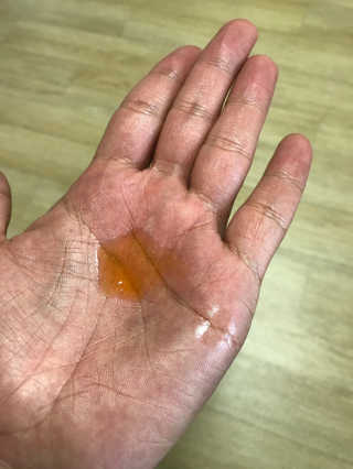 메디페르루테인앰플 3종 — 1.5점을 준 리뷰어가 2019년 8월 올린 사용 사진