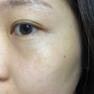 비엠비코 퀸79 노블 골드 아이크림 — 4점을 준 리뷰어가 2019년 12월 올린 사용 사진