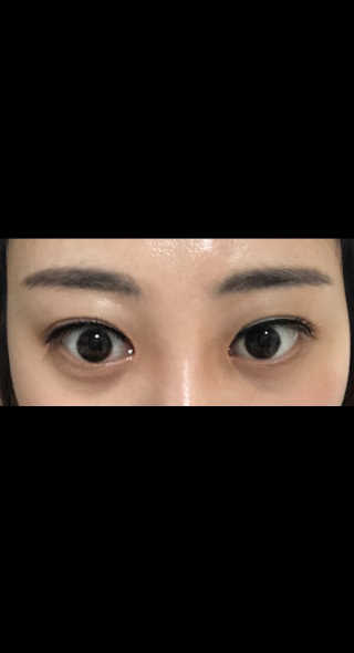 피카소 밍크래쉬속눈썹 1종 + 내추럴속눈썹 1종 랜덤증정 — 4점을 준 리뷰어가 2019년 9월 올린 사용 사진