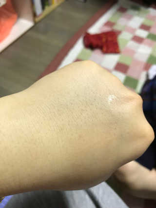 23years old 바데카실 오리지널 — 5점을 준 리뷰어가 2018년 3월 올린 사용 사진
