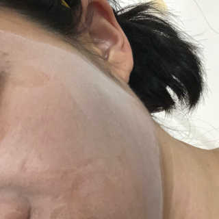 셀퓨전씨 트리악 포어 딜리트 버블 팩 — 3.33점을 준 리뷰어가 2018년 4월 올린 사용 사진
