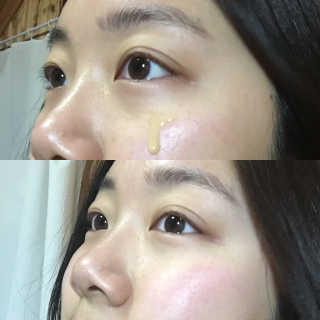 보타니티 [홍]조[진]정[결]케어 플라본 세럼 — 4점을 준 리뷰어가 2018년 5월 올린 사용 사진