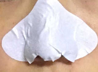 미팩토리 3단 돼지코팩 3매입 X 2 — 5점을 준 리뷰어가 2018년 3월 올린 사용 사진