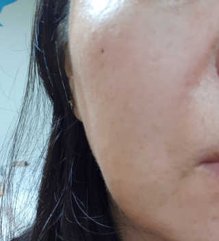 [라보드더마펌] 콜라제닉 미네랄 파우더 — 4점을 준 리뷰어가 2019년 9월 올린 사용 사진