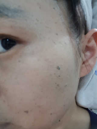 글랜무어 디톡 제올라이트 클리어링 버블 팩 — 4.33점을 준 리뷰어가 2018년 5월 올린 사용 사진