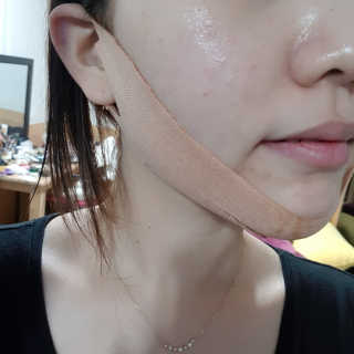 아이디플라코스메틱 아이디 페이스핏 마이너스 밴드 — 5점을 준 리뷰어가 2019년 12월 올린 사용 사진