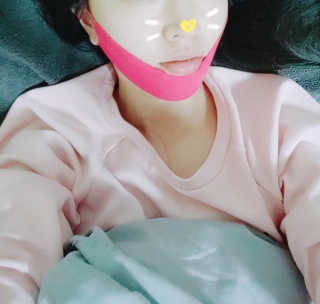 스케덤 펩타이드 리프팅밴드 — 5점을 준 리뷰어가 2019년 3월 올린 사용 사진