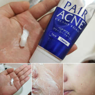 페어아크네 크리미폼 페어아크네 크리미 폼 — 5점을 준 리뷰어가 2019년 7월 올린 사용 사진