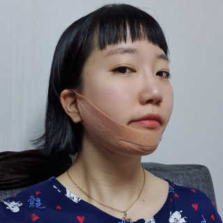 아이디플라코스메틱 아이디 페이스핏 마이너스 밴드 — 2점을 준 리뷰어가 2020년 3월 올린 사용 사진