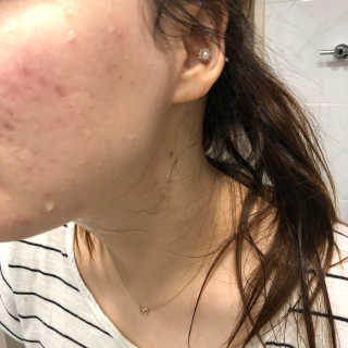 YejiChoi님이 올린 리뷰 사진 2