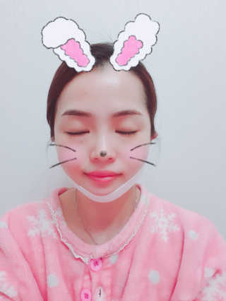 스케덤 클루덤 리프팅 패치 — 5점을 준 리뷰어가 2019년 3월 올린 사용 사진