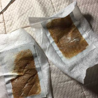 메디테라피 더마 릴렉스 힐링패치 — 5점을 준 리뷰어가 2018년 4월 올린 사용 사진