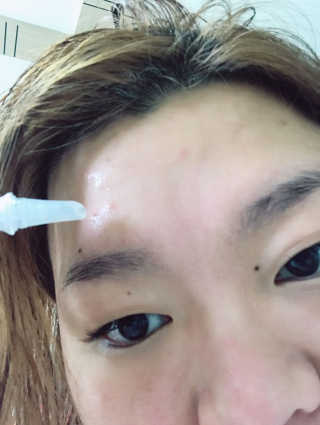 본비반트 티 솔루션 안티 블레미쉬 스팟 에센스 — 4.5점을 준 리뷰어가 2017년 3월 올린 사용 사진