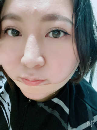 아이디플라코스메틱 아이디 페이스핏 마이너스 밴드 — 5점을 준 리뷰어가 2019년 12월 올린 사용 사진