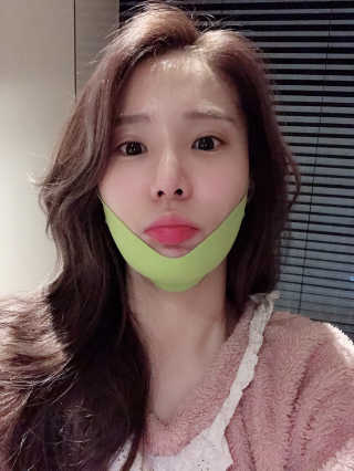 스케덤 시카 리프팅밴드 — 4점을 준 리뷰어가 2019년 4월 올린 사용 사진