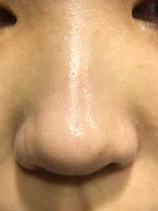 23years old 블랙페인트럽바 — 3.83점을 준 리뷰어가 2018년 7월 올린 사용 사진