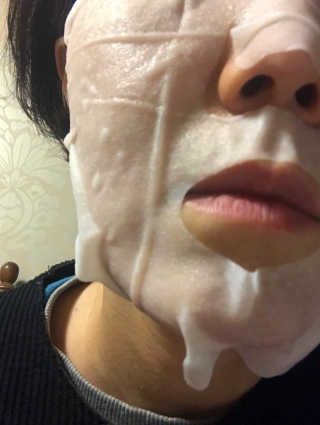 주식회사 태미스 태미스 뉴 히알루론산 마스크팩 10매 — 4점을 준 리뷰어가 2018년 12월 올린 사용 사진