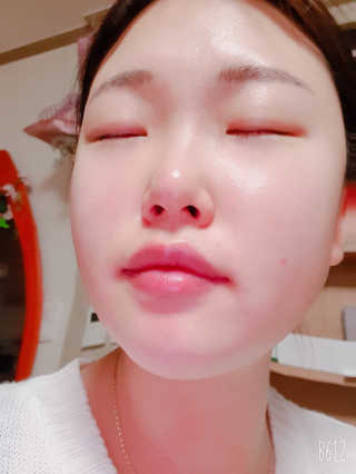 메디페르 루테인 포스앰플 50ml — 5점을 준 리뷰어가 2019년 10월 올린 사용 사진