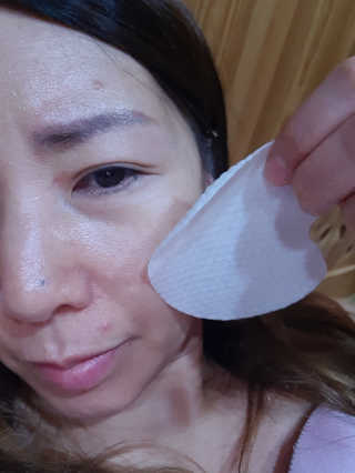 미플레이 진짜 티트리 토너 패드 — 5점을 준 리뷰어가 2018년 11월 올린 사용 사진